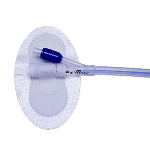 Urinary Catheter Securement Device Standard Sterile